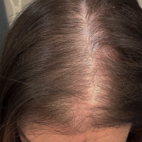 WEAK, THIN HAIR